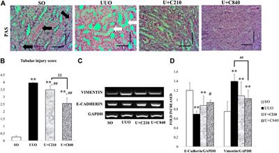 Centella asiatica Extract Attenuates Kidney Fibrosis Through Reducing Mesenchymal Transition and Inflammation in Ureteral Ligation Model in Mice